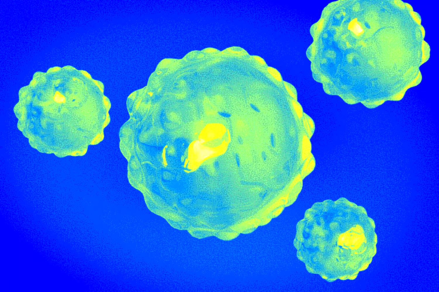 MBD_AIVirus_SM_08072026