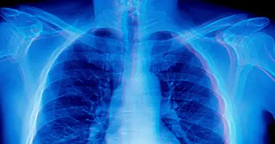 frontier-models-medical-advice-x-rays-cant-see